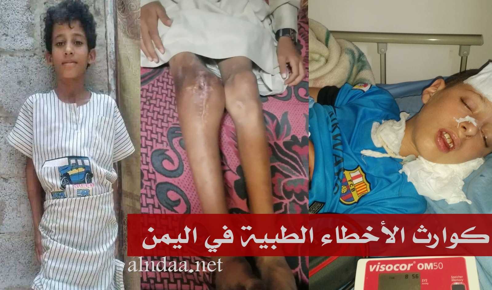 الأخطاء الطبية في اليمن.. انتكاسات تضع المنظومة الصحية على المحك